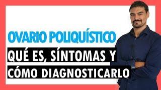 QUÉ ES EL OVARIO POLIQUÍSTICO, SÍNTOMAS Y CÓMO DETECTARLO