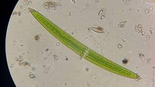 Desmid (single-celled microscopic green algae)