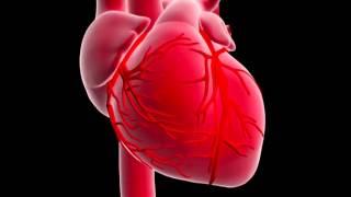 Che cos’è un infarto del miocardio ?