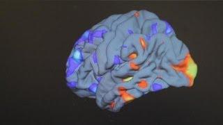 علماء أوروبيون يسعون لإيجاد علاج لمرض التوحد - science