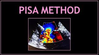 PISA METHOD! (Echocardiography/ MR assessment)