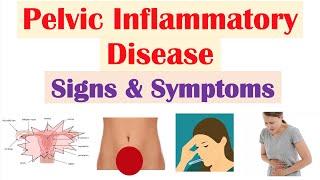 Pelvic Inflammatory Disease (PID) Signs & Symptoms (& Why They Occur)