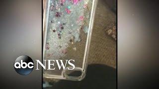 Glitter iPhone cases recalled after causing burns