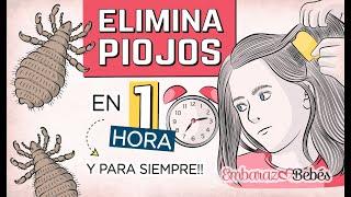 ‍️ 3 Remedios para ELIMINAR PIOJOS y Liendres en 1 HORA y para Siempre!!!