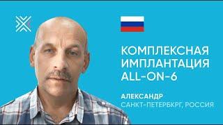 Имплантация и протезирование All-On-6: отзыв