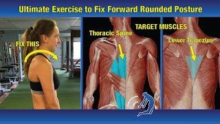 Ultimate Exercise to Fix Forward Rounded Shoulders - Heal Any Shoulder Injury (Part 3/5)