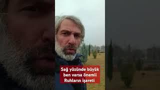 Sağ yanağında Ben varsa Ruhun kıymeti