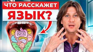 Язык КРИЧИТ о болезнях! / Как диагностировать болезни по языку?