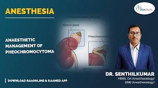 Anesthesia | Anaesthetic management of pheochromocytoma | Raaonline