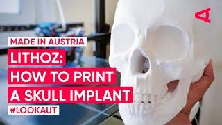 Lithoz: How to revolutionize ceramic 3D printing | LOOKAUT