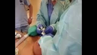 Airway Management During a Difficult Intubation Case