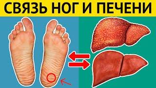 Как ноги сигнализируют о БОЛЕЗНЯХ ПЕЧЕНИ? Проверьте свои ноги!