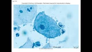 MICROBIOLOGY- GENITOURINARY INFECTIONS AND HIV/AIDS