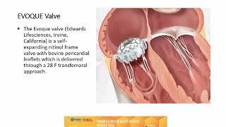 64. Future interventional therapeutic itineraries for the tricuspid valve | S. Samargandy