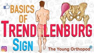 Trendelenburg's Sign | ANIMATION | BASICS | The Young Orthopod | Trendelenberg Sign