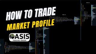 How to Trade Market Profile. Unique Trading Setups using Market Profile vs Volume Profile.