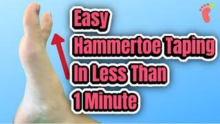 How to Tape a Hammertoe in Less Than 1 Minute | Hammertoe Taping Tutorial