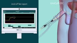 Performing The UroCuff Test - DC Disposable