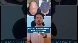 Breezula for Hair Regrowth | Hair Loss | Launch Date | Adon Hair Care #viral Viral