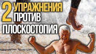 Какие упражнения от плоскостопия реально помогают