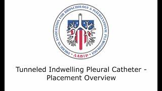 Tunneled Indwelling Pleural Catheter-Placement Overview