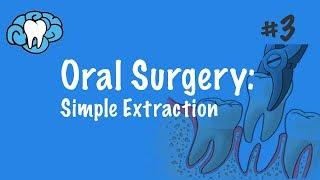 Oral Surgery | Simple Extraction | INBDE, ADAT