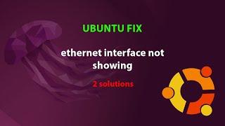 UBUNTU FIX: ethernet interface not showing