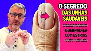 Como ter unhas fortes e saudáveis?