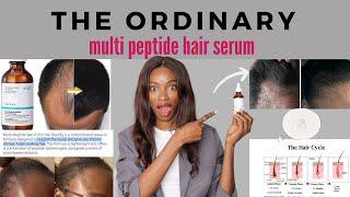 The Ordinary MULTI-PEPTIDE HAIR SERUM | EXTREME HAIR  GROWTH? A Chemist Perspective