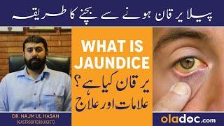 Yarkan Ka Ilaj In Urdu - Jaundice Symptoms Treatment - Peela Yarkan Kyun Hota Hai - Viral Hepatitis