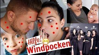 Hilfe!Windpocken!  Das erste Event mit Baby | Familien Vlog |MAYRA JOANN