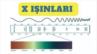 X Işınları Nedir ? X Işınlarının Keşfi