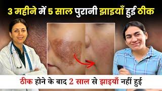 झाइयों को किया 100% ठीक | Pigmentation Melasma Treatment | Dr. Upasana Vohra #skin #skincare