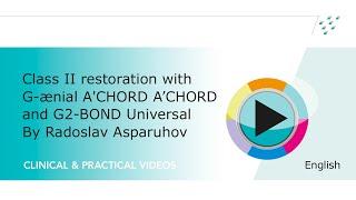 Class II composite restoration with G-ænial A’CHORD & G2-BOND Universal by Radoslav Asparuhov