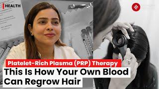 PRP Hair Treatment: How This Therapy Helps Hair Growth With Your Own Blood | PRP Therapy Explained