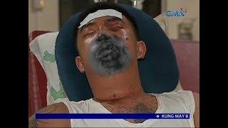 24 Oras: Binatilyo, nasabugan ng vape sa bibig