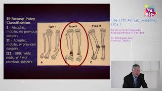 IPOS | Day 1 | M. Kocaoglu - Treatment of Congenital Pseudoarthrosis of the Tibia