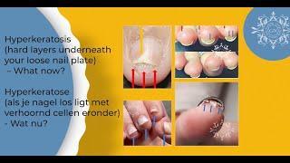 RELEAF & RECOVERY for Hardened Skin Cells between the Nail Plate & the Nail Bed