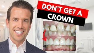 Watch this before getting a Dental Crown!