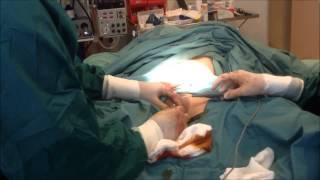 Vaginal Tightening Surgery, Dr Daood Sydney Plastic Surgeon - Part 1