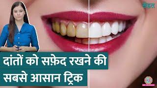 सफ़ेद, चमकते दांतों के लिए Teeth Whitening करवानी चाहिए या नहीं? |  Sehat ep 964