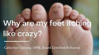 Why are my feet itching like crazy?