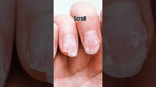 (Dont mind commet at the end)your nails if you ..