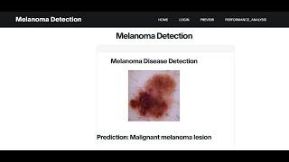 Melanoma Detection Using Convolutional Neural Network | Python Final Year IEEE Project