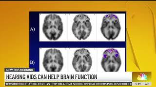 Hearing Aids Slow Cognitive Impairment