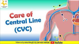 Care of Central Venous Catheter | Care of Central Line | Central line & Nursing considerations.