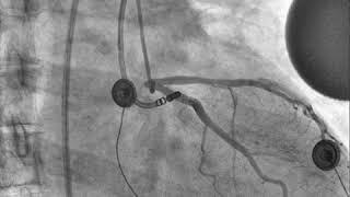 Biotok XR & CF Angiography Cardio