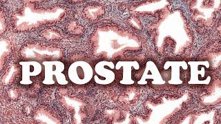 LA PROSTATE - HISTOLOGIE