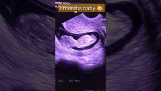 3 months baby on ultrasound/ shortvideo/ shorts