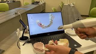Intraoral Scanning in Digital Dentistry